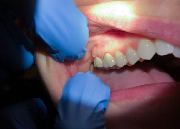 Best Same-Day Emergency Dental Services in Ridgeway, VA