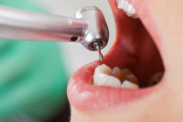 Best After-Hours Dental Trauma Care in Ridgeway, VA